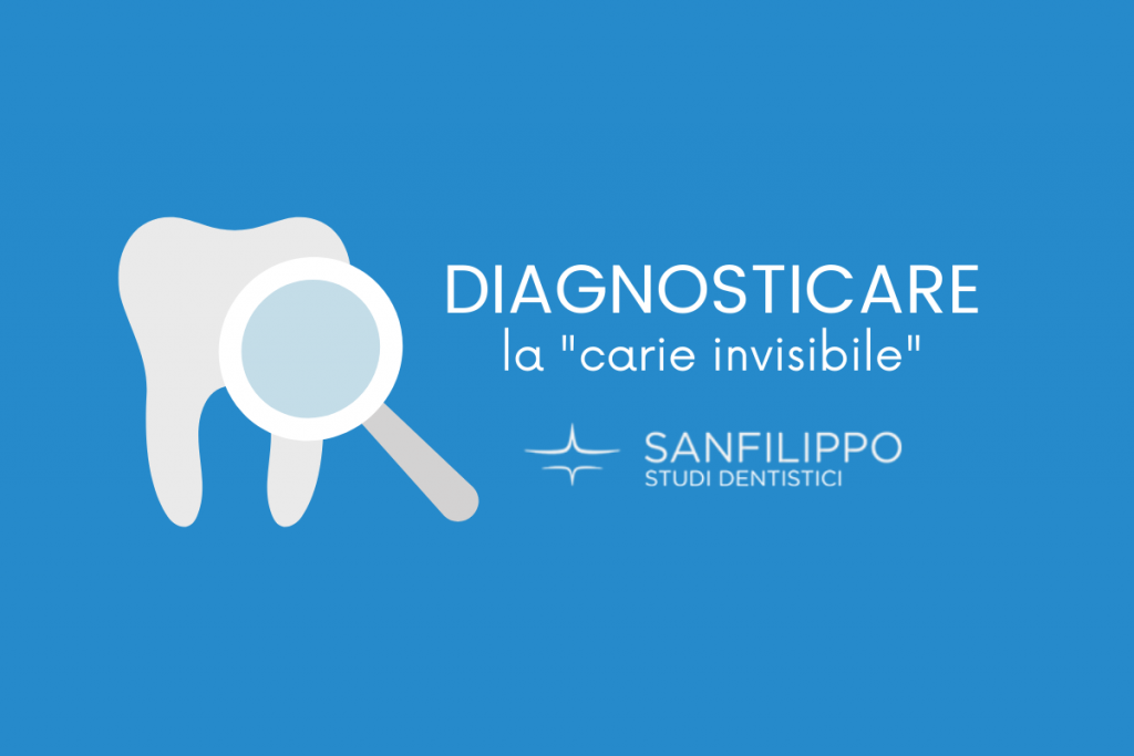 CARIE INTERPROSSIMALE DENTISTA CATANIA SANFILIPPO DENTISTA MILANO